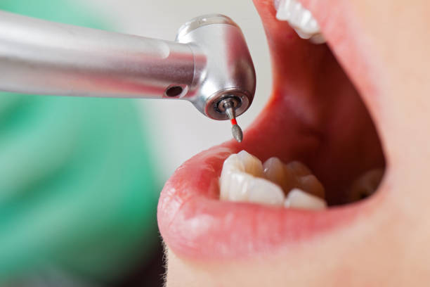 Best Emergency Broken Tooth Repair in South Fulton, GA